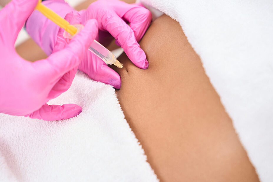 A person receives a lifting injection on her abdomen
